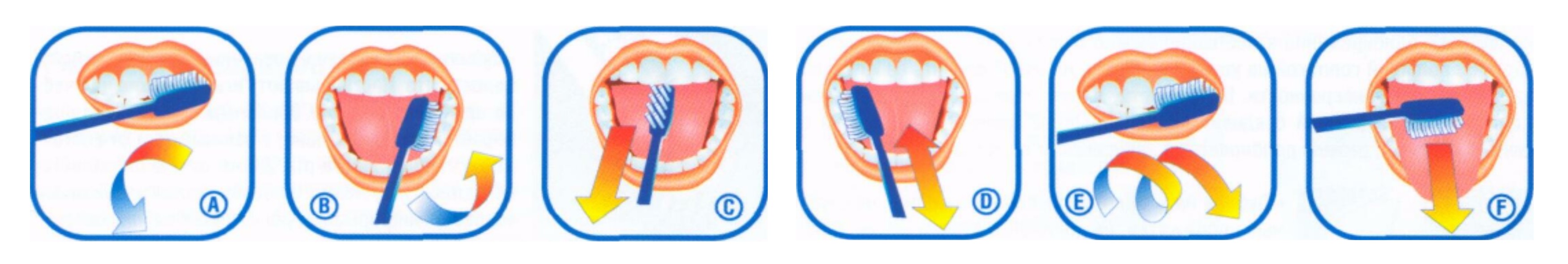 Гастроскопии можно чистить зубы. Схема правильной чистки зубов. Схема чистки зубов для детей. Схема чистки зубов для дошкольников. Схема как правильно чистить зубы.