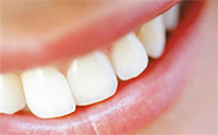 изумительно белые зубы